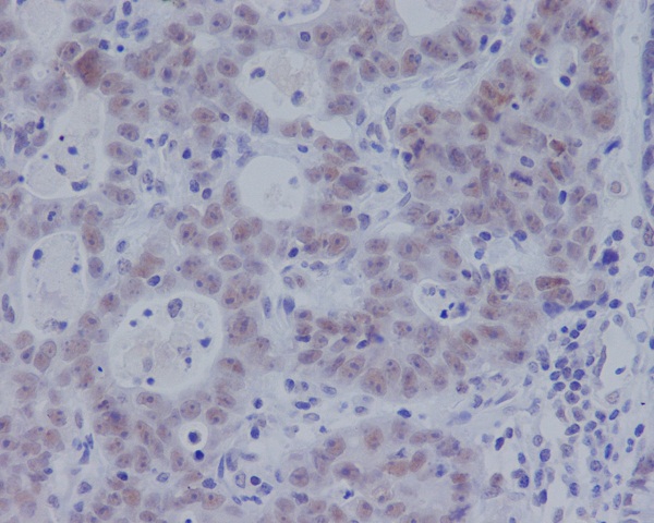 IHC - Anti-Phospho-Smad3 (S423 + S425) Rabbit Monoclonal Antibody ABO13199